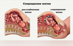 Гипертонус матки - Причины, симптомы, лечение и профилактика